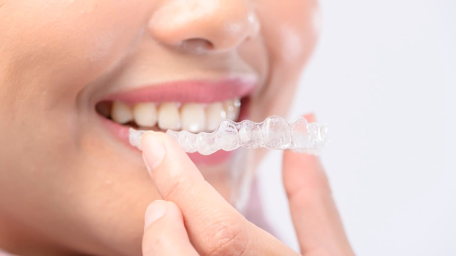 Comprehensive Guide to Choosing the Best Dental Clinic in Chennai