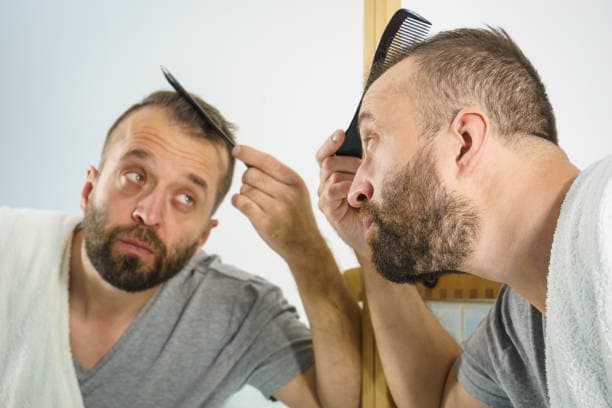 Real Hair Transplant Cost Explained by Experts