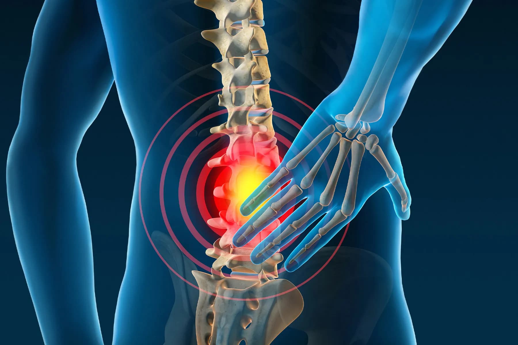 Back pain: Why Your Posture Might Be the Real Problem