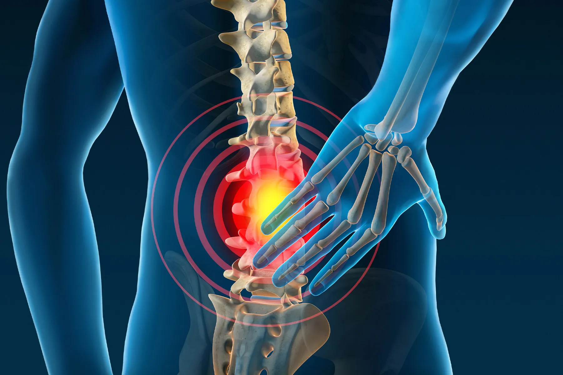 Back pain: Why Your Posture Might Be the Real Problem