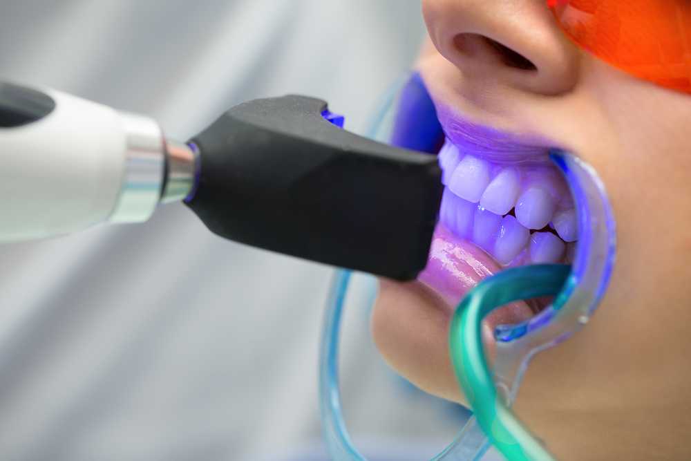 Achieving a Perfect Smile with Level Orthodontics North