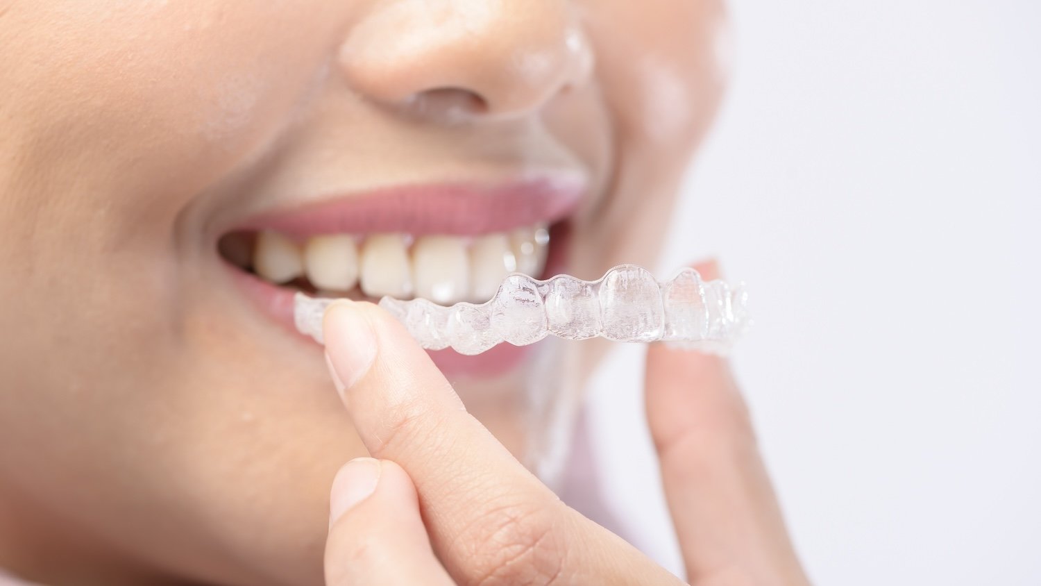 Comprehensive Guide to Choosing the Best Dental Clinic in Chennai
